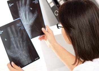 Araxá amplia subespecialidades para cirurgias ortopédicas