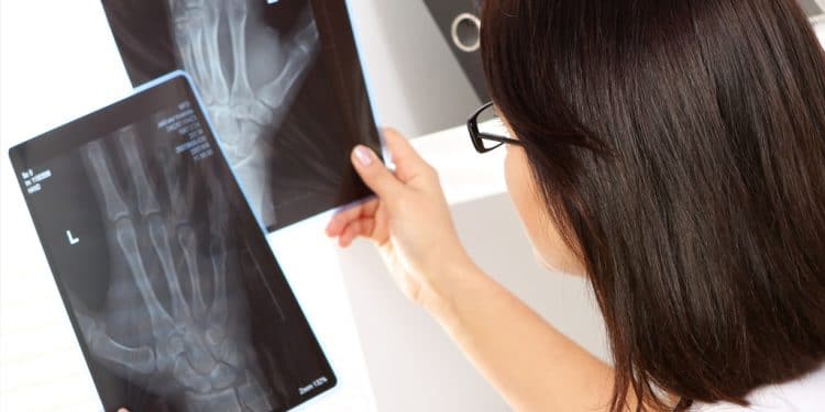 Araxá amplia subespecialidades para cirurgias ortopédicas