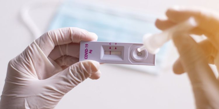 Com redução nos estoques, testes rápidos de Covid-19 voltam a ser feitos somente na Unisul a partir de segunda (24); confira as orientações da Secretaria Municipal de Saúde