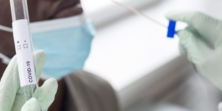 Prefeitura de Araxá amplia locais de testagem de Covid-19