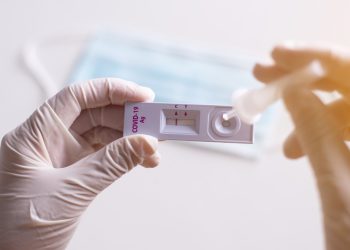 Com redução nos estoques, testes rápidos de Covid-19 voltam a ser feitos somente na Unisul a partir de segunda (24)