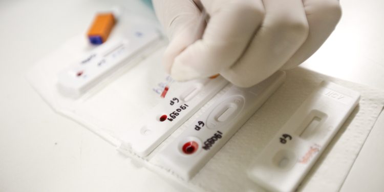 Aumento de casos de sífilis preocupa profissionais da saúde