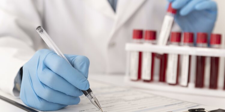 Ferritina alterada pode indicar anemia e doenças inflamatórias