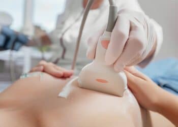 Araxá realiza agendamento de 300 exames gratuitos de mamografia no Calçadão, neste sábado