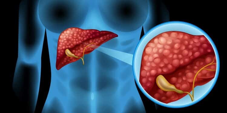 Hepatites virais: medidas preventivas e diagnóstico precoce podem salvar vidas