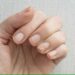 Conheça 4 alterações nas unhas que podem indicar problemas de saúde