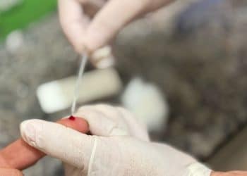 Dia de Combate às Hepatites Virais alerta para riscos e reforça serviços de prevenção e testagem em Araxá