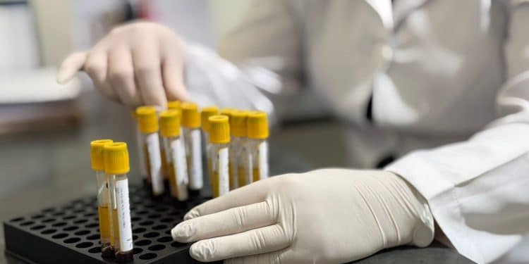 Laboratório Municipal de Araxá conquista nota máxima em avaliação nacional de qualidade