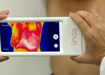 Projeto Linda Lifetech realiza entrega dos resultados e reforça convocação para realização dos exames