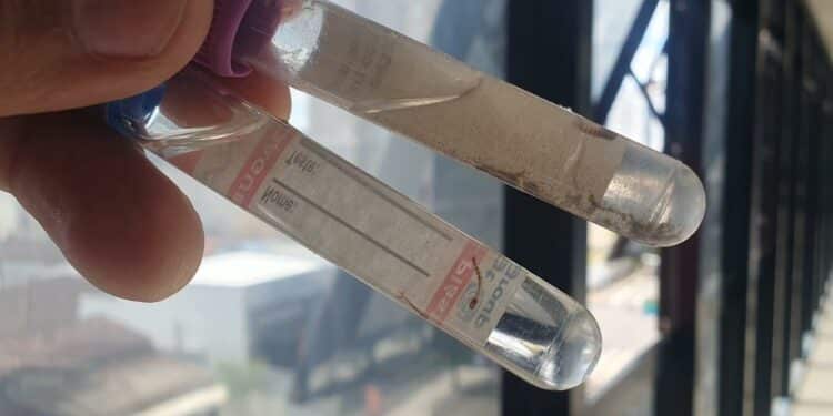 Novo LIRAa aponta média infestação para o Aedes aegypti em Araxá