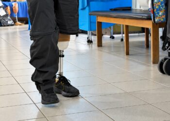 Oficina Ortopédica Itinerante atende 150 pacientes de Araxá e região