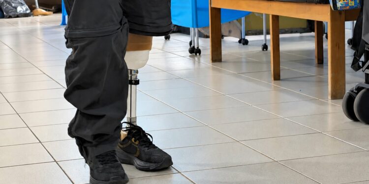 Oficina Ortopédica Itinerante atende 150 pacientes de Araxá e região