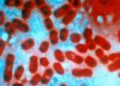 Rússia descarta risco de epidemia após morte de funcionária de laboratório por peste