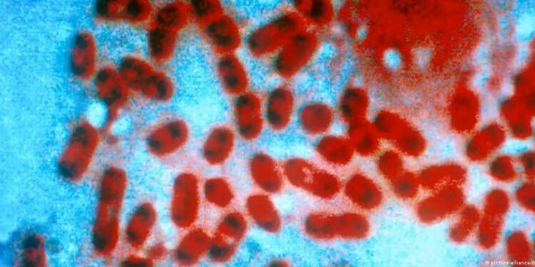 Rússia descarta risco de epidemia após morte de funcionária de laboratório por peste